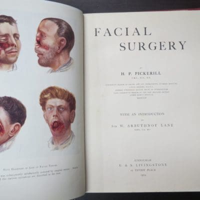 H. P. Pickerill (Surgeon-in-Charge of Facial And Jaw Department, Dunedin Hospital, Lieut.-Colonel NZMC) Facial Surgery, With An Introduction by W. Arbuthnot Lane, E. & S. Livingstone, Edinburgh, 1924, Medicine, Health, Military, New Zealand Military, Dunedin, Dead Souls Bookshop, Dunedin Book Shop