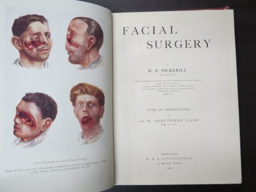 H. P. Pickerill (Surgeon-in-Charge of Facial And Jaw Department, Dunedin Hospital, Lieut.-Colonel NZMC) Facial Surgery, With An Introduction by W. Arbuthnot Lane, E. & S. Livingstone, Edinburgh, 1924, Medicine, Health, Military, New Zealand Military, Dunedin, Dead Souls Bookshop, Dunedin Book Shop